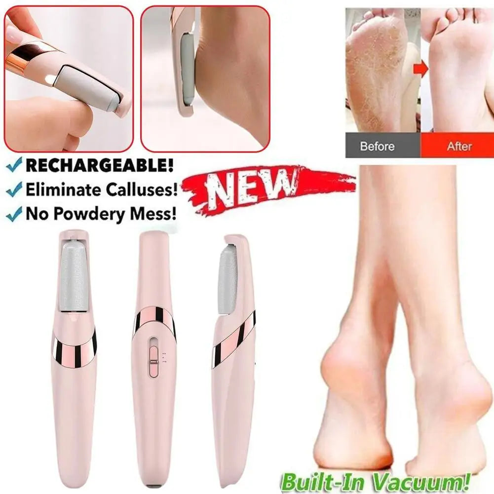 Electric Automatic Foot Scrubber – Dead Skin & Callus Removal Machine